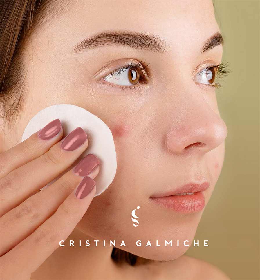 ¡Vamos al grano! Conoce 6 de las imperfecciones frecuentes del cutis