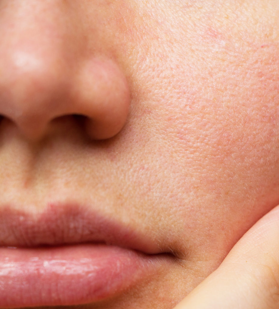 Descubre qué es la inflamación invisible de la piel en invierno y cómo devolverle equilibrio y luminosidad con Cristina Galmiche