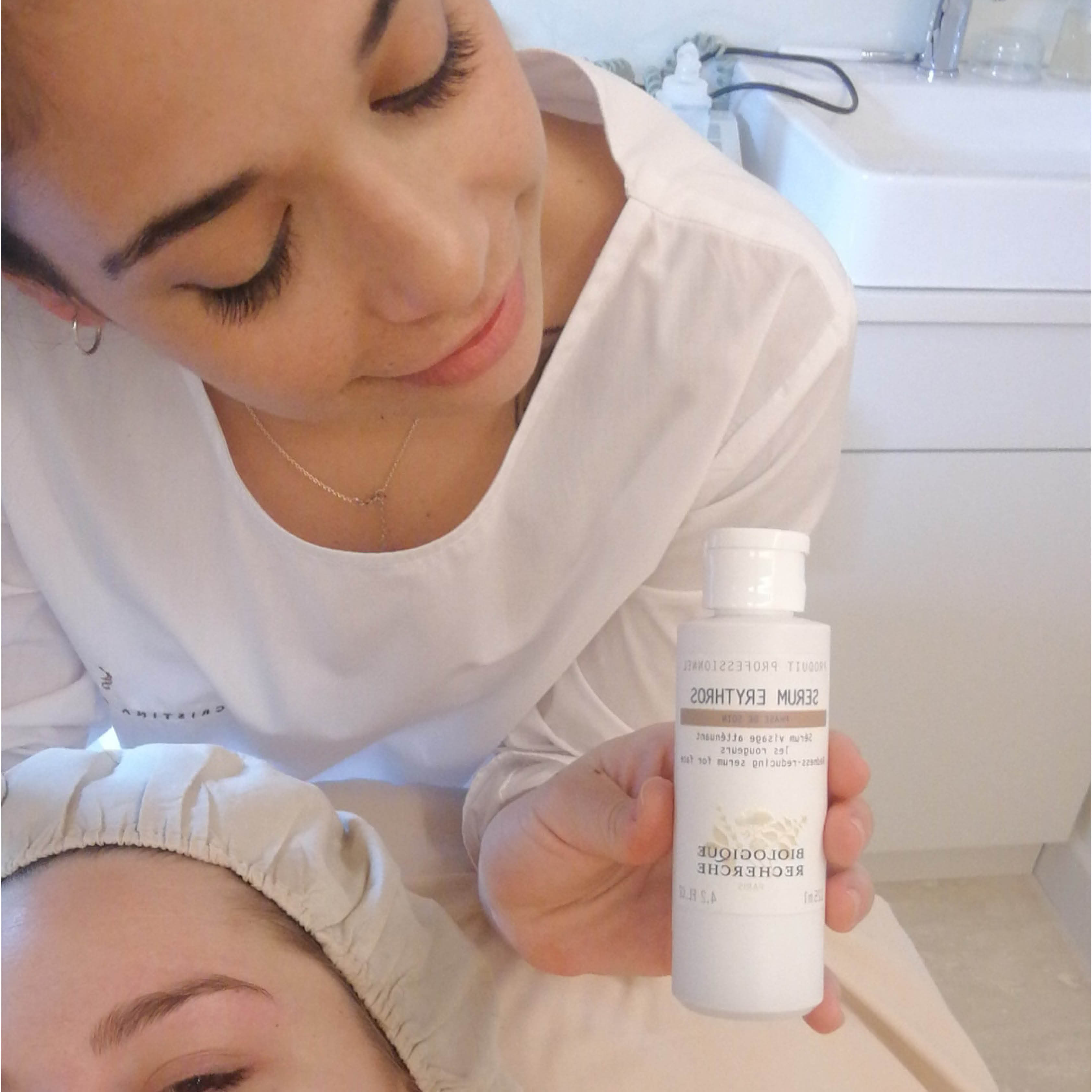 tratamiento de oxigenacion contra la rosacea