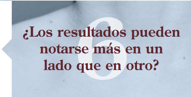 10-claves-Emsculpt-NEO-contenido7